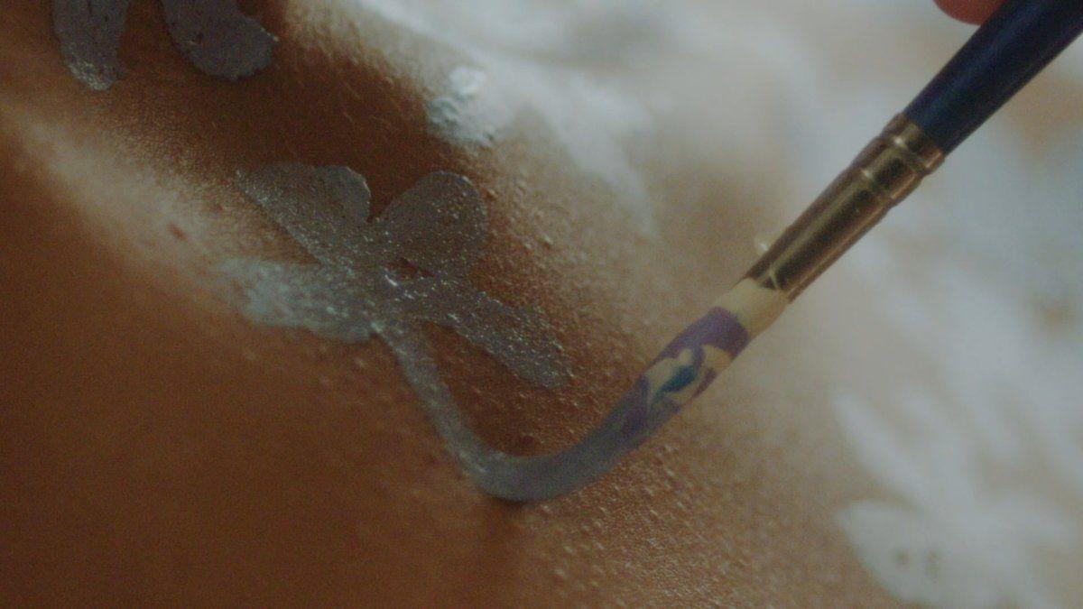 فك الألغاز حول مرض الصدفية